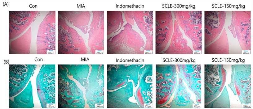 Histopathological features of knee joint tissues in monosodium iodoacetate (MIA)-induced osteoarthritis (OA) rats. Knee joint tissues histopathological changes with (A) H&E and (B) Safranin-O/Fast Green