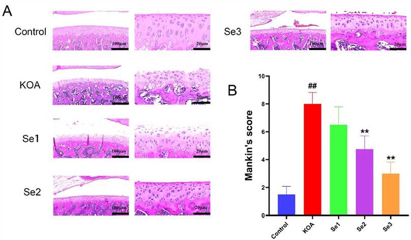 Effect of non-weight-bearing exercise on knee joint pathology in papain-induced rats with KOA. (A) Pathological features of the knee joint of rats with KOA observed after H&E staining. (B) Mankin score of cartilage tissue of knee joint in rats with KOA