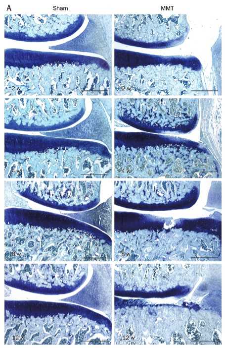 Changes in articular cartilage during OA progression. (A) Representative images with toluidine blue O staining.