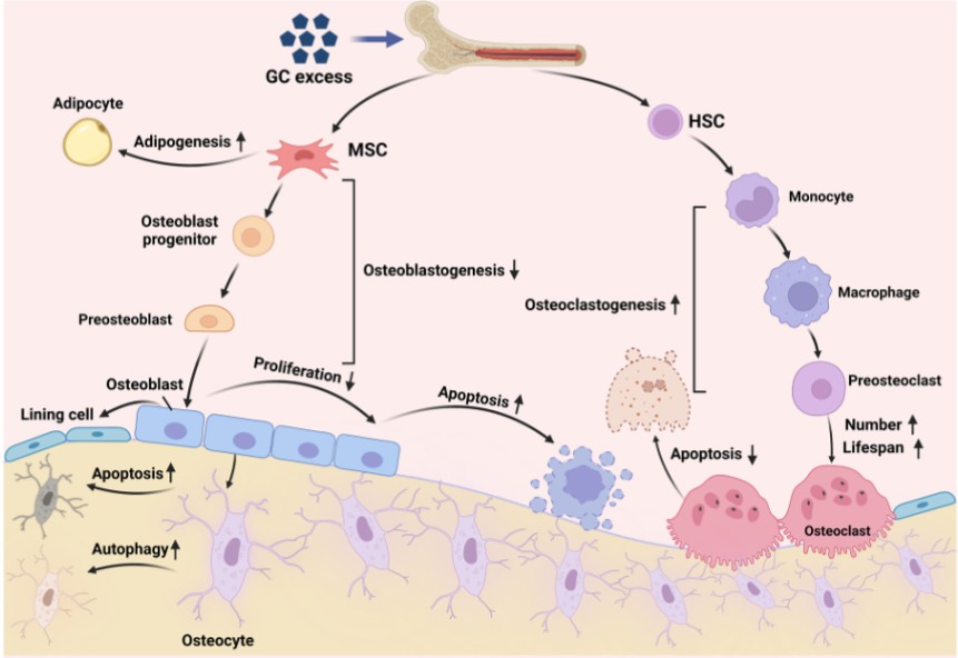 Effects of GC excess on bone cell. GC, glucocorticoids