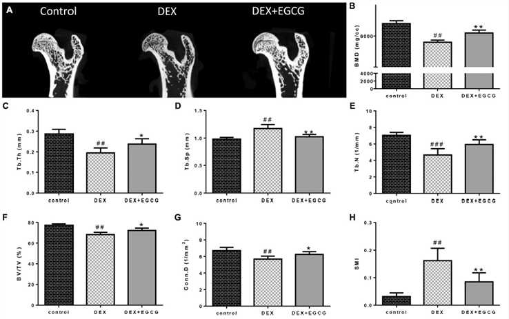 Effects of EGCG on trabecular bone micro-architecture in GIO rats. (A) micro-CT of proximal femurs. (B) Data from BMD measurements of femurs by DXA. The following computed tomographic indices were analyzed in the defined region of interest (ROI): (C) Tb.Th, (D) Tb.Sp, (E) Tb.N, (F) BV/TV, (G) Conn.D, and (H) SMI.