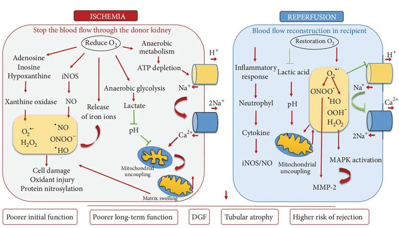 Schematic diagram of renal ischemia-reperfusion injury mechanisms.