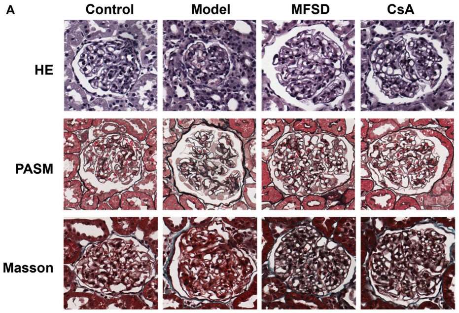 MFSD treatment improves glomerular pathology in PHN rats, as shown by representative renal pathological images. HE, PASM, and Masson staining reveal significant structural improvements.