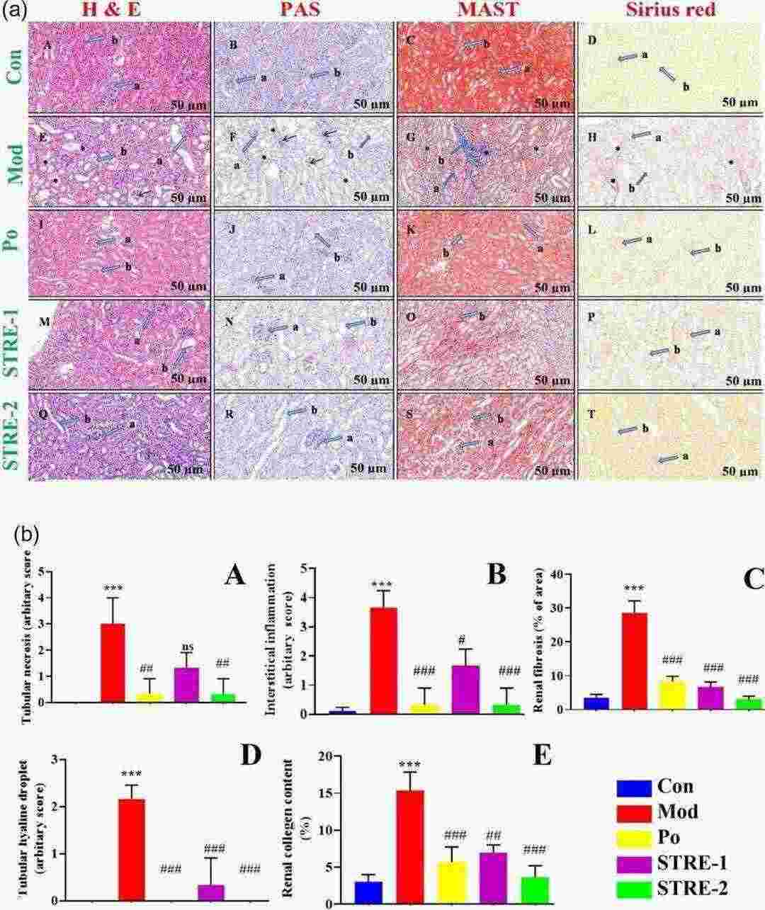 Effect of Stevia residue extract on renal histology in adenine-induced CKD mice, as shown by H and E, PAS, MAST, and Sirius Red staining.