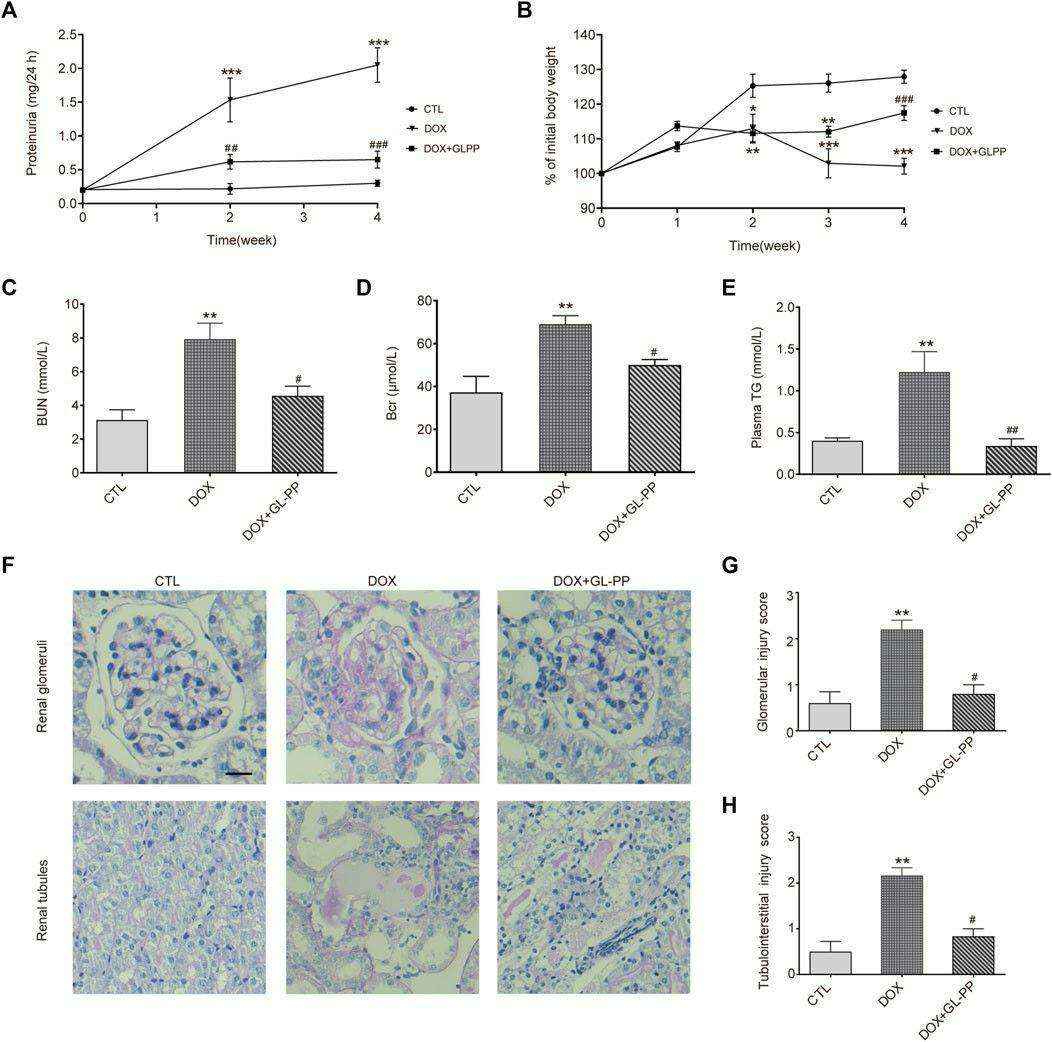 Effects of GL-PP on DOX-induced proteinuria, renal dysfunction, body weight, blood urea nitrogen, creatinine, plasma triglycerides, and renal PAS staining with injury scoring.