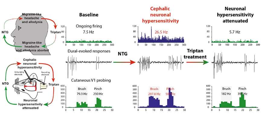 Schematic representation showcasing the application of nitroglycerin (NTG) in modeling migraines across both experimental and clinical studies, highlighting its role in translational research.