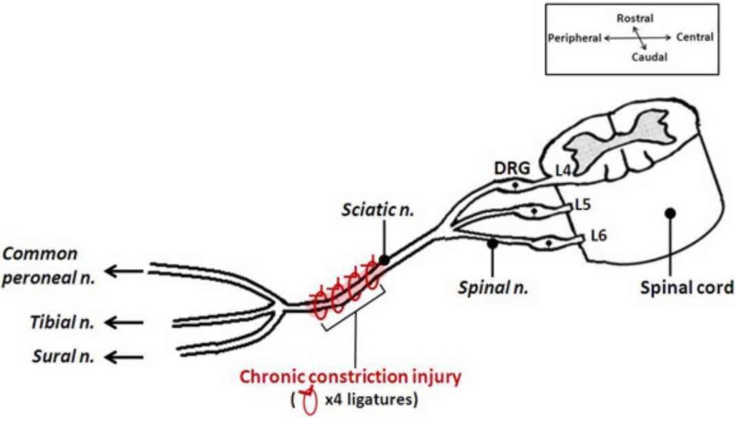 Diagram depicting the placement of ligatures as part of the chronic constriction injury (CCI) model.