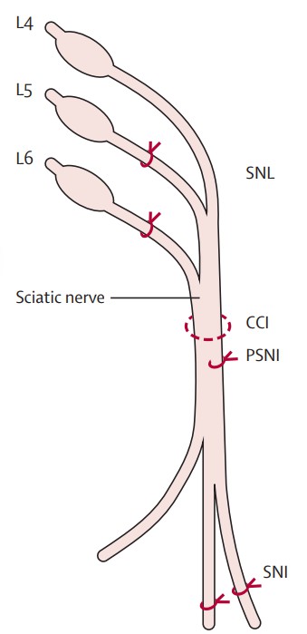 Schematic diagram showcasing various rodent models of traumatic nerve injury, including the Spared Nerve Injury (SNL), Chronic Constriction Injury (CCI), Partial Sciatic Nerve Injury (PSNI), and Sciatic Nerve Injury (SNI) models.