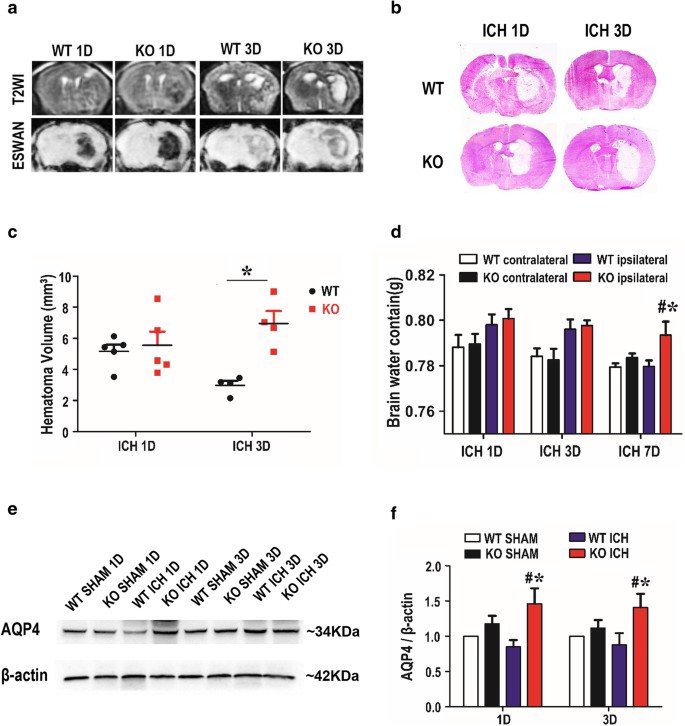 TREK-1-deficient mice post-ICH showing increased hematoma volume on day 3 and higher brain water content on day 7. Includes MRI, HE staining, hematoma volume, brain water content, and AQP4 expression analyses.