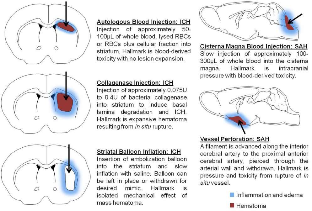 Schematic illustrating the models frequently employed to simulate intracerebral hemorrhage (ICH) and subarachnoid hemorrhage (SAH)