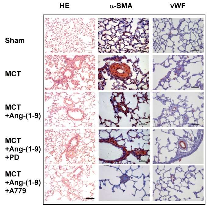 Schematic diagram illustrating the effects of Ang-(1-9) on the inhibition of pulmonary arterial intimal proliferation induced by monocrotaline (MCT).