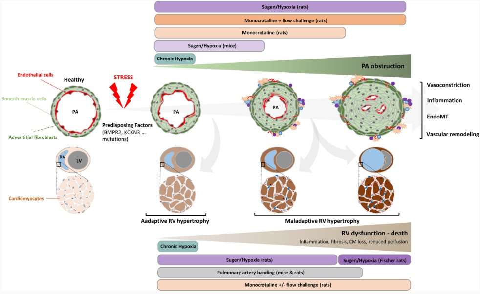 Schematic overview of the progression of pulmonary arterial hypertension (PAH) with commonly used animal models for studying pathophysiology and testing potential treatments or preventive interventions.