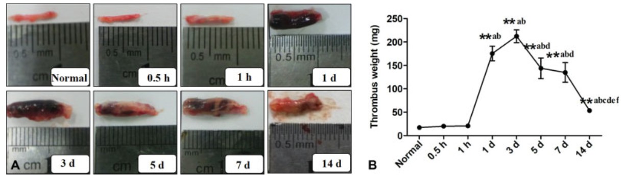 Figure depicting the effect of inferior vena cava (IVC) stenosis on deep vein thrombosis (DVT) in Sprague-Dawley rats. Panels show representative IVCs (A) and thrombus weights (B) at various post-surgical time points.