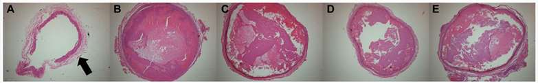 H and E-stained images of FeCl3-induced thrombus from different treatment groups.