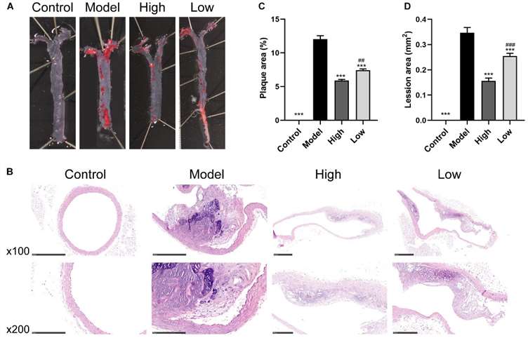 Schematic diagram of the effects of berberine on atherosclerosis induced by a high-fat diet in mice including Oil Red O staining of the aorta, H&E-stained aortic root sections, and quantitative assessments of plaque and lesion sizes.