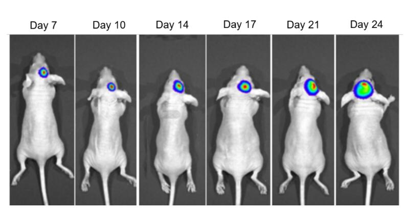 In vivo imaging of the U87MG-Luc2 brain orthotopic tumor model, showcasing real-time tumor growth and development within the brain.