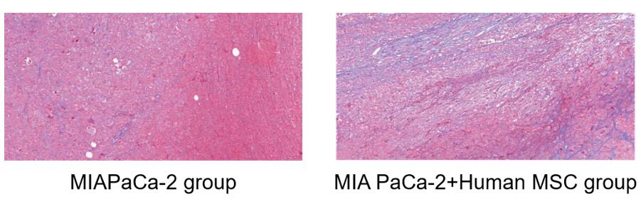 Masson staining reveals enhanced fibrous structures in tumors co-inoculated with MSCs and tumor cells, contrasting with tumors from tumor cells alone.