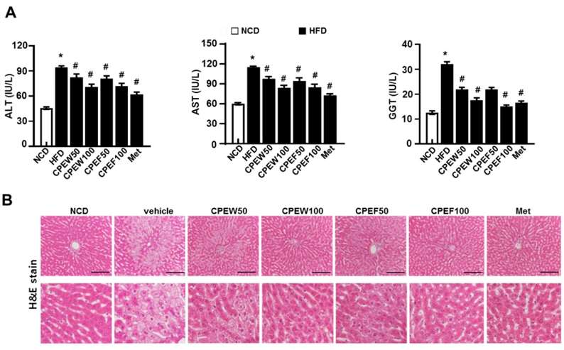 Citrus peel extract mitigates HFD-induced liver damage in rats.