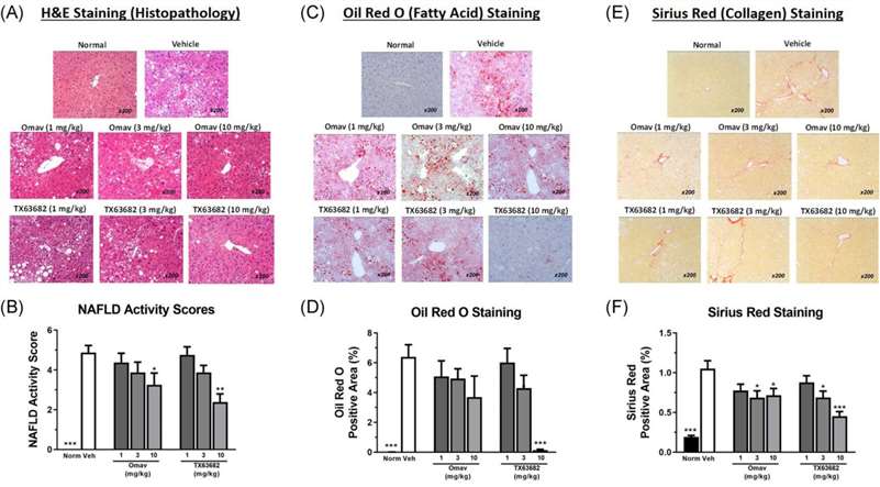 Liver protection of omaveloxolone and TX63682 in NASH Model.