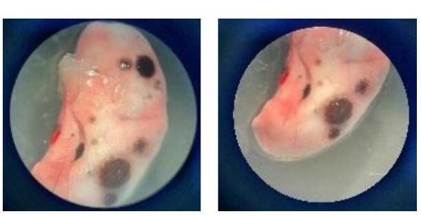 C57BL/6 mice injected with B16-F10 melanoma cells, showing lung metastases at study end.