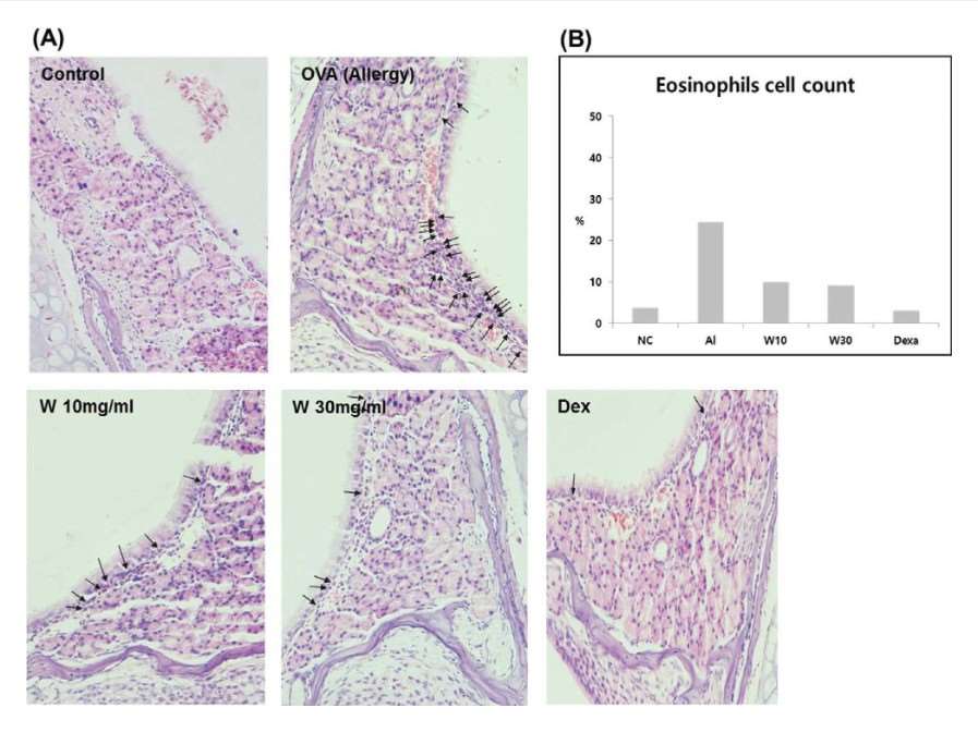 Wogonin's impact on eosinophil filtration in AR mouse nasal mucosa.