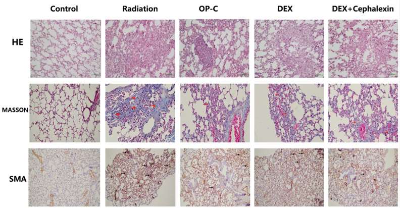 Effects of Ophiopogonin C on lung tissue post-irradiation.