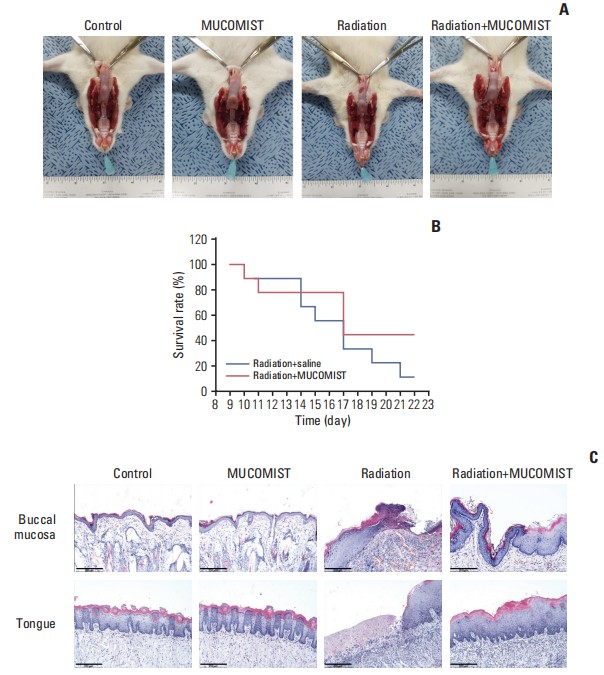 Protective effect of N-acetyl cysteine (NAC) against histopathologic effects in irradiated rats. (A) Photographic images of buccal mucosa on day 23 after irradiation. Rats in the radiation group were found to have more tongue mucositis (the tip of the tongue is not fully healed). However, the MUCOMIST(NAC) treatment group is clean except for the tip of the tongue. (B) Survival rate and time of death. There was no statistical significance between the treatment and non-treatment groups. (C) Histopathologic images (H&E staining, ×400) of buccal mucosa and tongue on day 23 after irradiation.