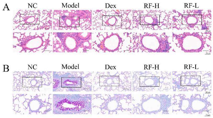 The effects of Renifolin F on histopathologic changes in the lung tissues of OVA-induced allergic mice in vivo. (A) Lung tissue sections were stained with H&E. (B) Lung tissue sections were stained with PAS. Normal control, saline-induced mice only. Model, OVA-induced mice. Dex, OVA-induced mice treated with Dex (1.0 mg/kg). RF-H, OVA-induced mice treated with Renifolin F (3.0 mg/kg). RF-L, OVA-induced mice treated with Renifolin F (1.5 mg/kg).