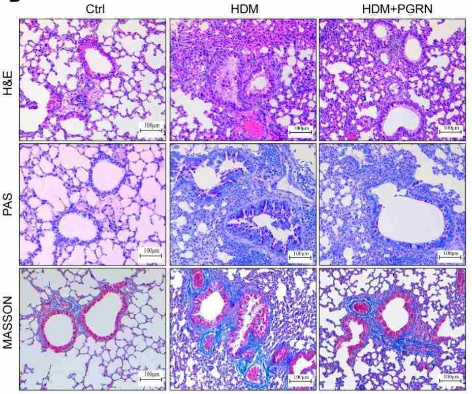 H&E, PAS and Masson's trichrome staining of lung sections from different groups