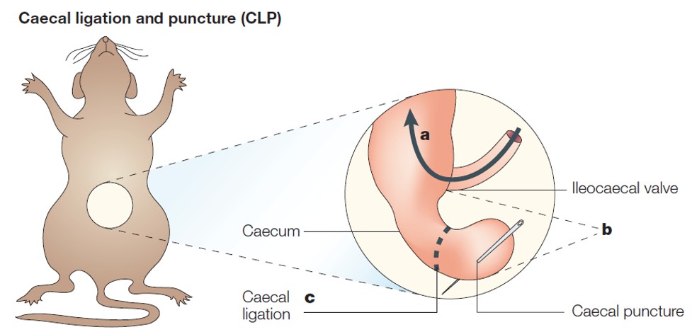 CLP-induced sepsis model