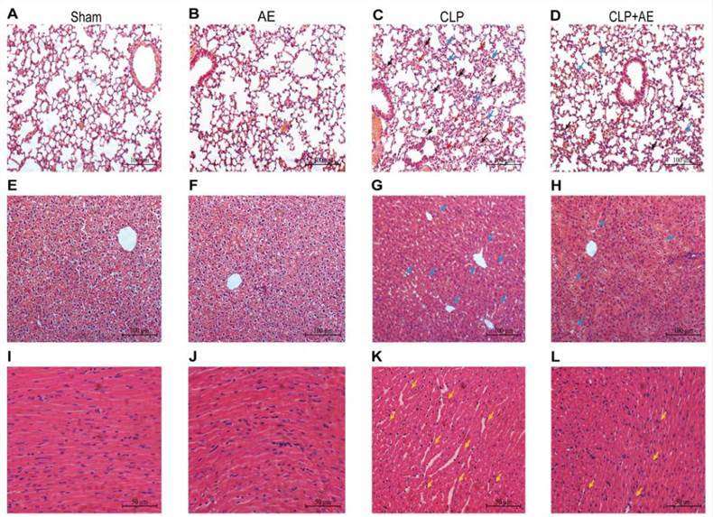 AE's protective effects against lung, liver, and heart tissue lesions in mice with CLP-induced sepsis. Representative microscopic images of hematoxylin and eosin (H&E) staining of (A–D) lung, (E–H) liver, and (I–L) heart tissue from mice with CLP-induced sepsis