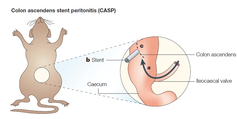 CASP model of sepsis