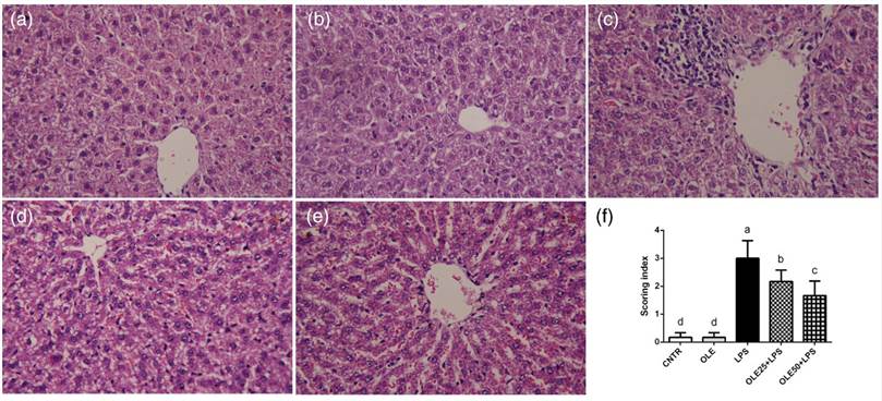 Lipopolysaccharide (LPS)-Induced Sepsis Model | Creative Bioarray