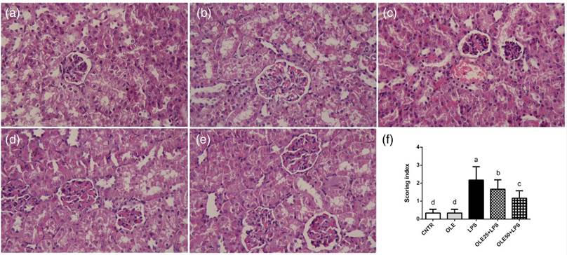 Histological changes in the kidney tissue in the examined groups. (a) control group, (b) OLE-treated group, (c) lipopolysaccharide (LPS)-treated group, (d) OLE25 + LPS treated group, (e) OLE50 + LPS treated group, and (f) Kidney scoring index