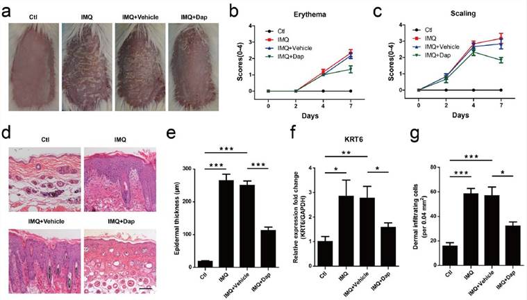 The effect of daphnetin on skin lesion in IMQ-induced psoriasis-like mouse model. (a) The macroscopic appearance of mouse back skin on day 8. (b) Erythema and (c) scaling was scored on days 0, 2, 4, and 7 based on the PASI. (d) H&E staining of the mouse skin. (e) Epidermal thickness was calculated by Image-pro Plus 6.0 software. (f) qRT-PCR was performed to measure the expression of KRT6 in skin lesion. GAPDH served as an internal reference. (g) Dermal cellular infiltrates were quantitated with H&E staining images.