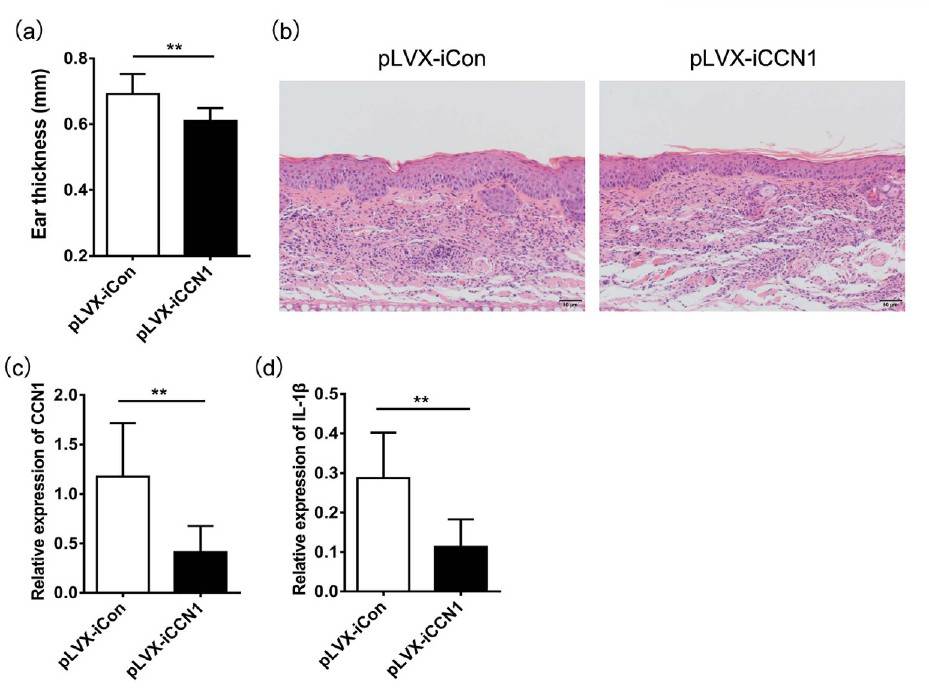 Decreased IL-1β expression in IL-23-induced psoriasis-like mice by knocking down CCN1 expression.