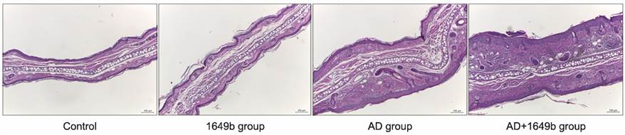 Histological examination confirmed that epidermal and dermal thickness were increased with dermal inflammatory cell infiltration in the AD+1649b group compared to the AD group (H&E, Scale bar=100 μm).