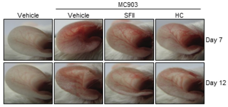 MC903-induced ear skin inflammation of BALB/c mice treated with SFII, or HC on days 7 and 12.