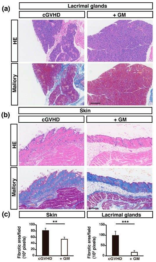 Pathological analysis of cGVHD mice: H&E and mallory staining of LGs and skin.