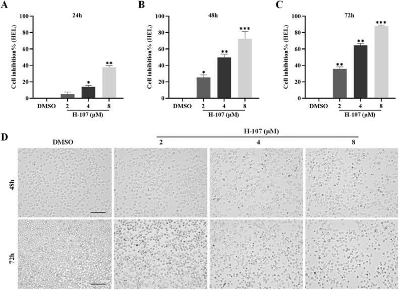 Fig. 1 H-107 inhibited HEL cell proliferation.