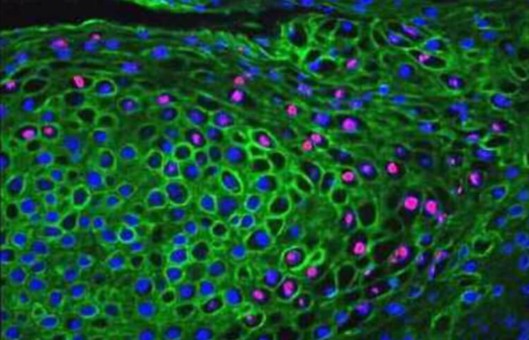 Fluorescent In Situ Hybridization (FISH) Service