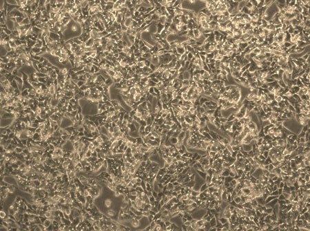 Diagram of Human liver carcinoma epithelial cells.