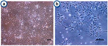 The proliferation and structural characteristics of human neural progenitor cells on on Antheraea mylitta and mori 3D scaffolds.