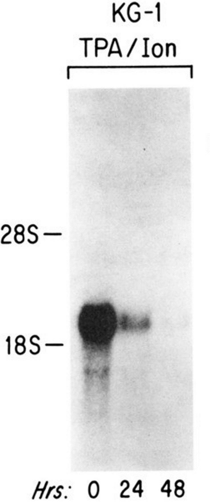 Total RNA was isolated from KG-1 cells treated with 10-7 mol/L TPA and 1.6 μg/mL ionomycin for the indicated times. Ten micrograms of total RNA per sample were blotted and probed with a 32P-labeled 1.6 kb Xba I fragment of the CD34 cDNA.