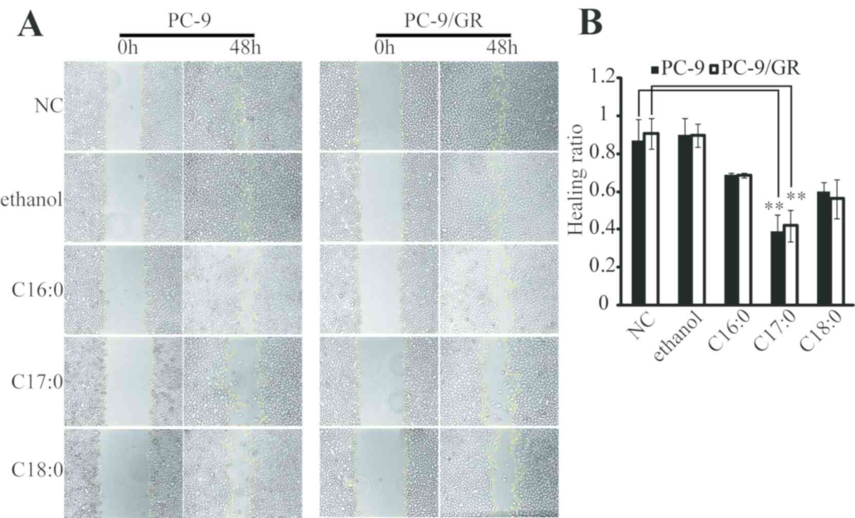 (A) PC-9 and PC-9/GR cells were seeded in 6-well plates and incubated for attachment overnight. A scratch was made in the confluent cell layer using a pipette tip and culture media with various fatty acids (100 µM). No serum was added, followed by incubation for 48 h. Finally, images of the cells were captured using an optical microscope. (B) Each group's cell layer wound healing ratios were statistically analyzed with ImageJ software.