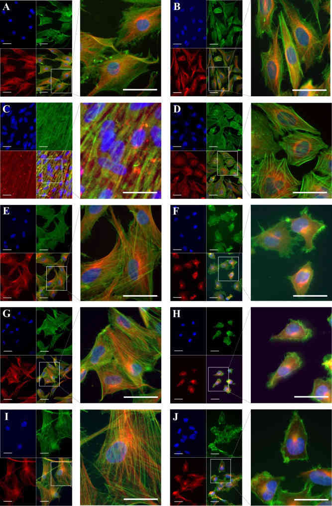 Cytoskeleton structure in musculoskeletal cancer lines and healthy cells.