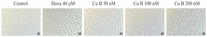 Effect of Cu B (50-200 nM) and doxazosin (40 μM) on the cellular morphology of BPH-1 cells treated for 48 h (100×).