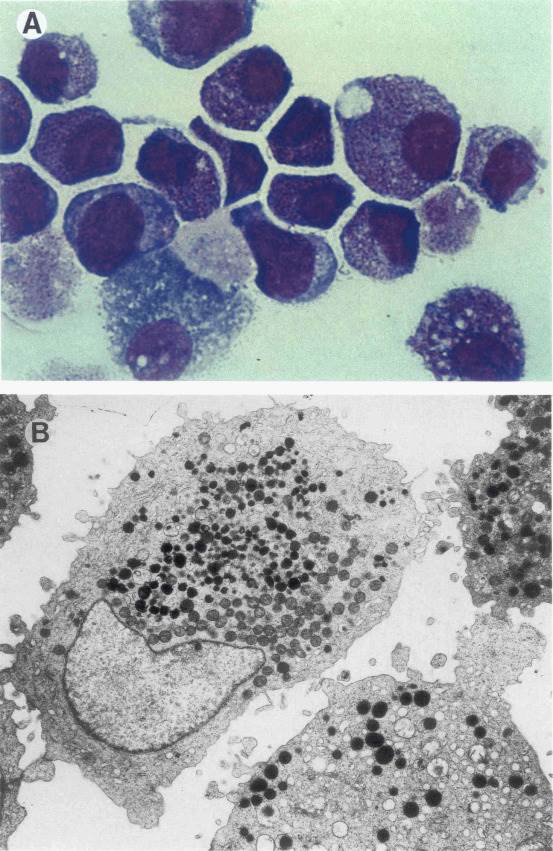 (A) A cytocentrifuged preparation stained with MGG is shown. (B) Electron photomicrograph of GF-D8 cultured cells showing an eccentric nucleus and cytoplasm containing numerous mitochondria, primary granules, and empty vesicles.