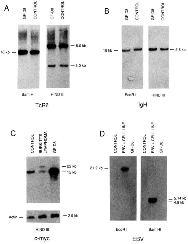 The germline configuration of the δ chain of the T-cell receptor gene (A) as well as of the Ig heavy chain (B). The amplification of the c-myc gene and the lack of EBV DNA integration in GF-D8 cells are presented in (C) and (D).