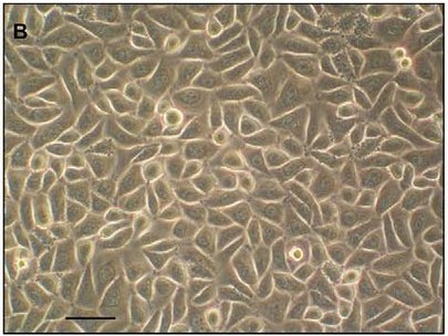 Human gingival epithelial cells.